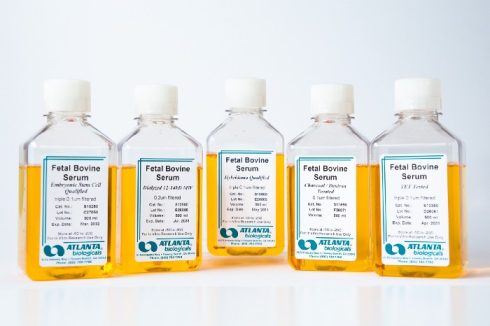 سرم جنین گاوی