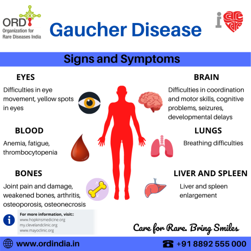 بیماری-گوچر-gaucher-disease چیست؟