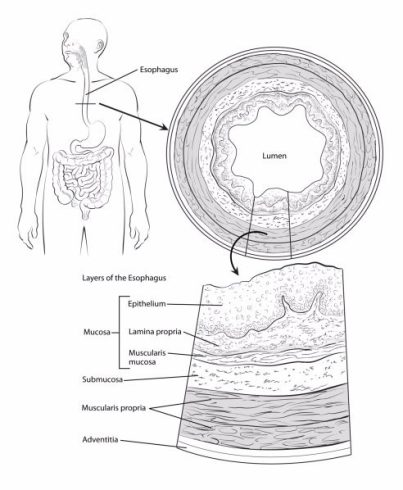 سرطان مری (Esophagus Cancer) چیست؟