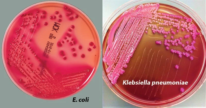 مک کانکی آگار (MacConkey Agar)