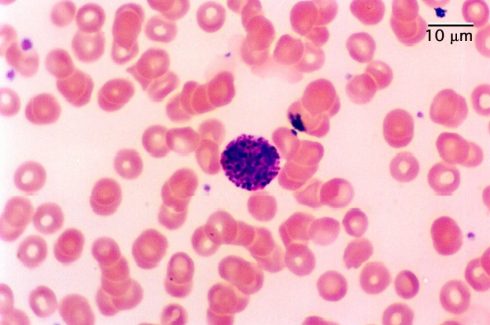 رنگ های رومانوفسکی: رنگ رایت گیمسا