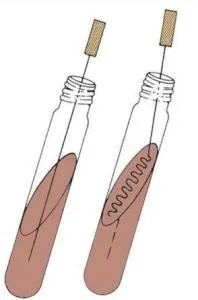 کلیگلر آیرون آگار (Kligler’s Iron Agar (KIA)) اصول، رویه، نتایج