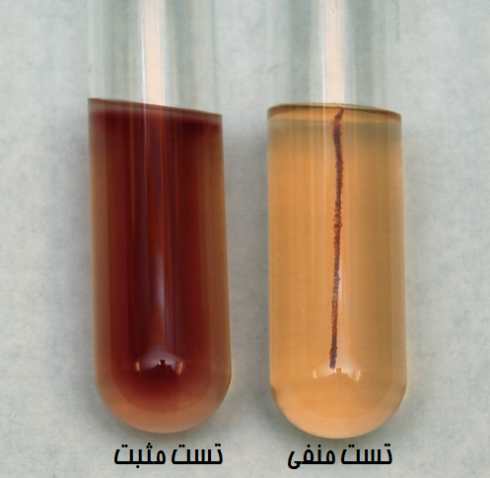 تست موتیلیتی