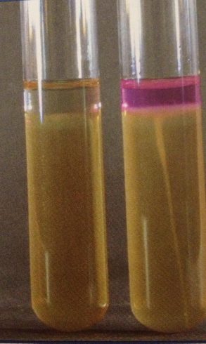 تست موتیلیتی