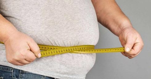 علل پسوریازیس چاقی