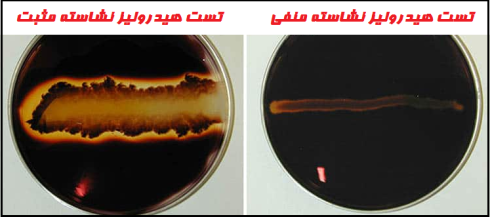 تست هیدرولیز نشاسته