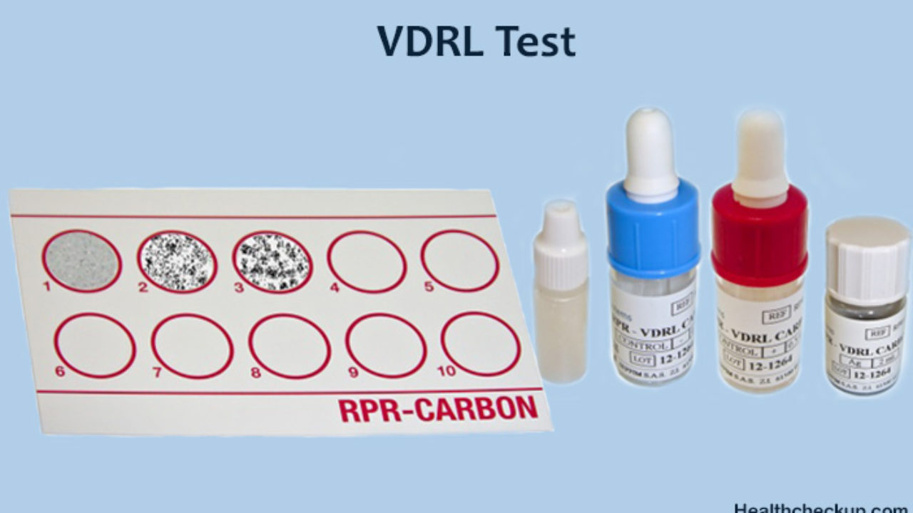 آزمایش VDRL چیست؟ اصول، مراحل و تفسیر نتایج | ژنیران