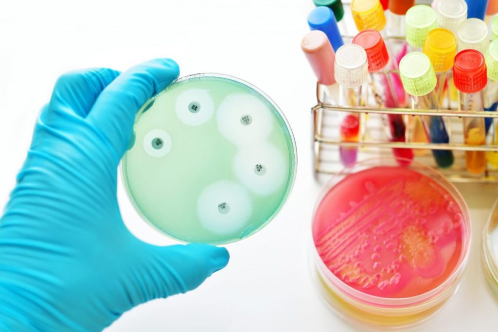 تست حساسیت ضد میکروبی چیست؟