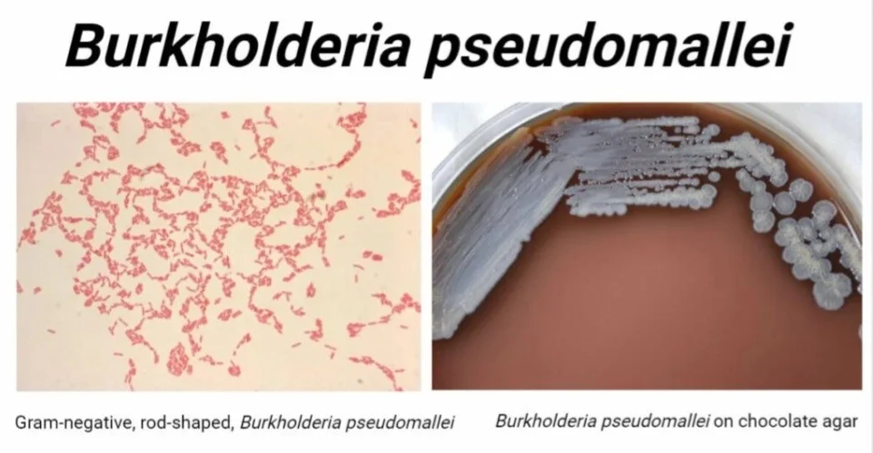 مورفولوژی بورخولدریا پسومالئی