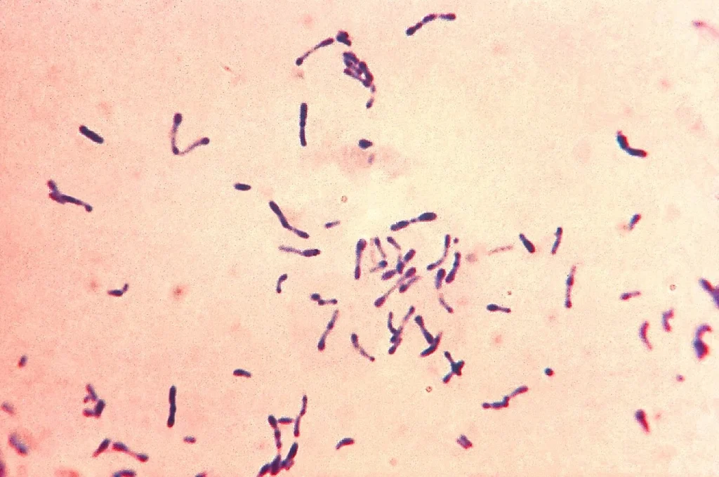 کورینه باکتریوم دیفتری (C. Diphtheriae)